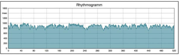 Rhythmogramm VNS Analyse